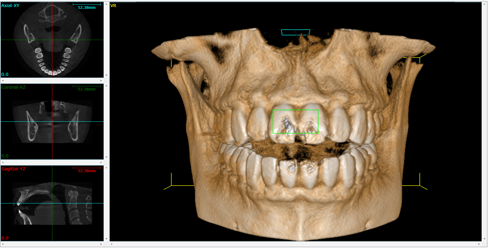 Cone Beam 3D Imaging  Tracy, CA
