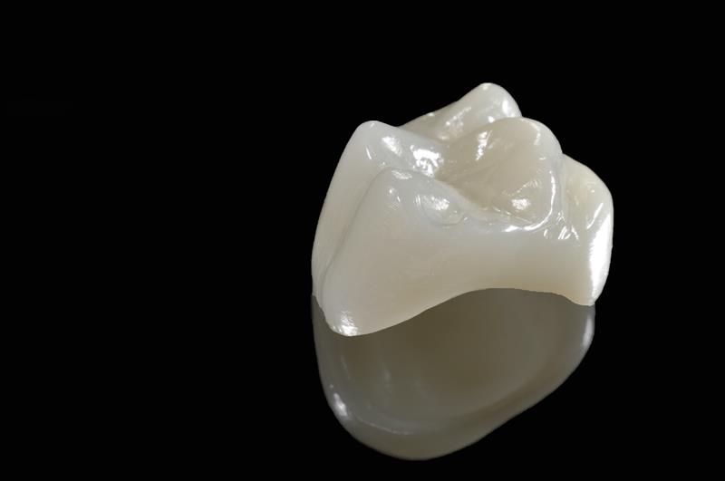 Porcelain Crowns Tracy, CA